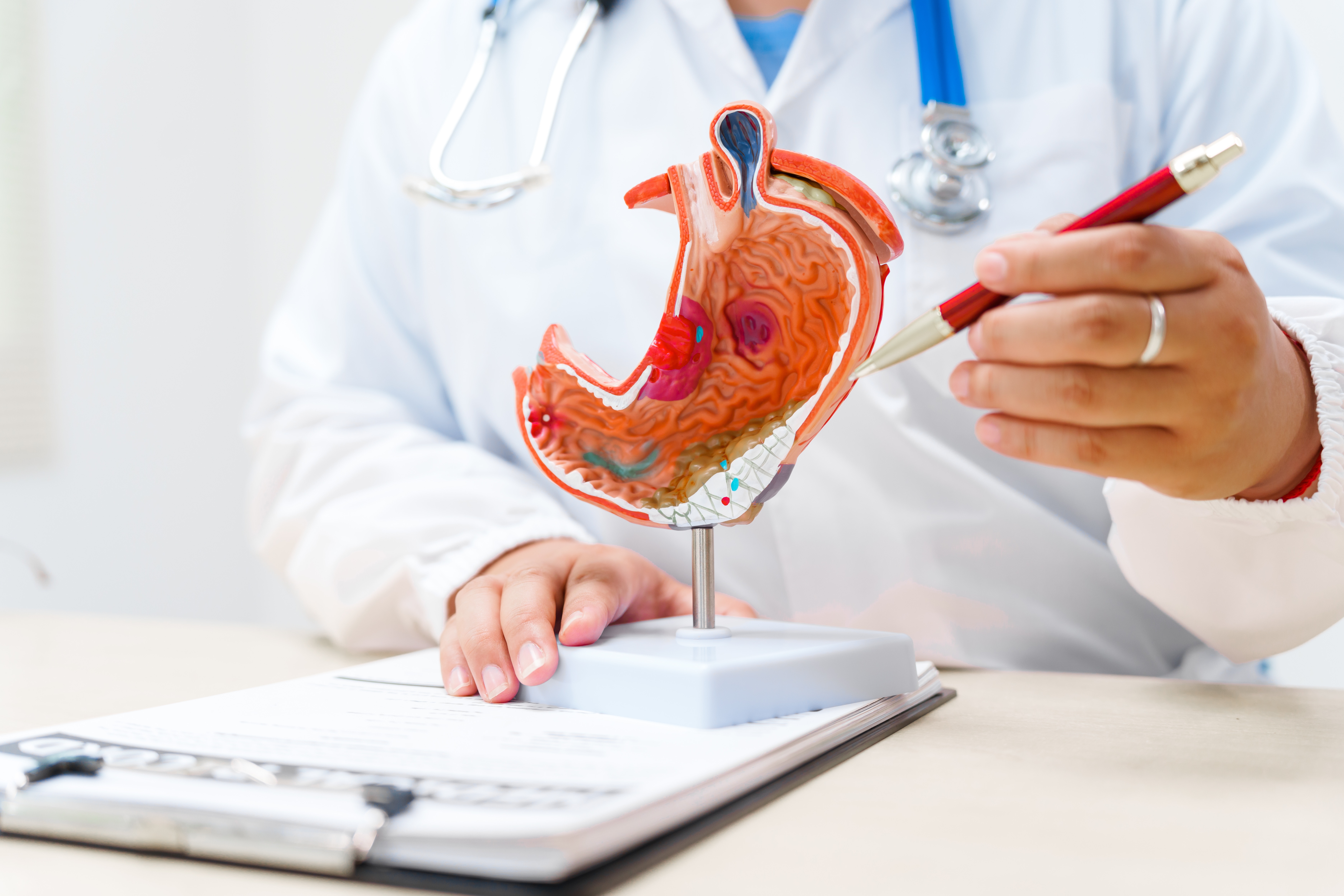 Gastroenterologist Anatomical Model Stomach Problems