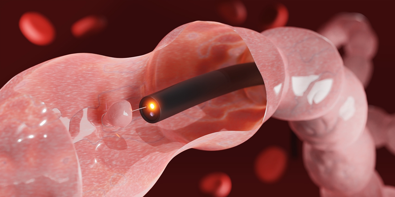 Endoscopy Rendering